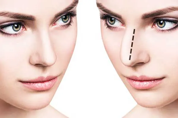 تجميل الأنف وجراحة العيون